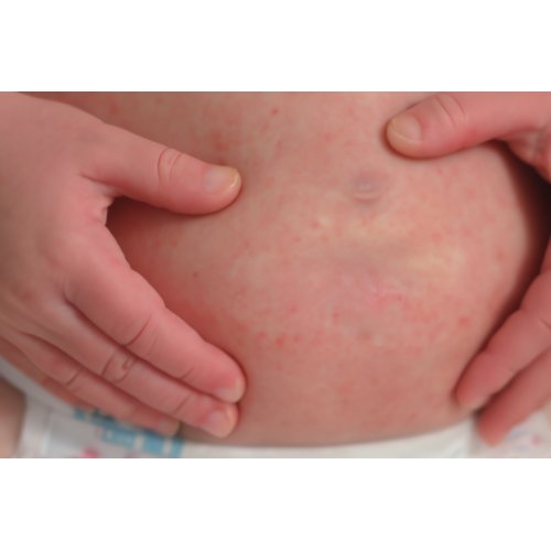 Doğum Sonrası Kilolar: En İyi Diyet Listeleri, Sağlıklı ve Sürdürülebilir Zayıflama Yöntemleri